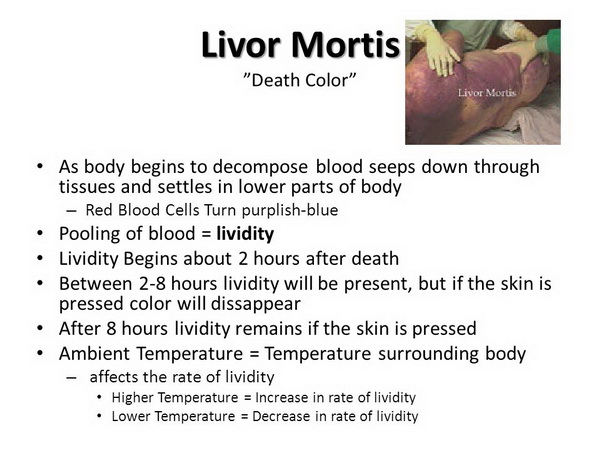 Livor+Mortis+Death+Color.jpg